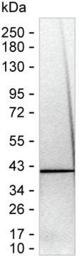 ASRGL1